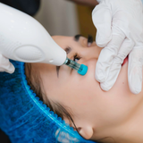  CÔNG NGHỆ THUỶ LỰC ÂM MINIUS HYDRAULIC 