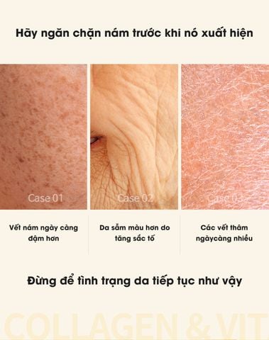  KEM DƯỠNG GAI VI KIM COLLAGEN CAO CẤP Dr.VITA DAYCELL Dr.VITA PREMIUM COLLAGEN & VITAMIN CAPSULE CREAM 