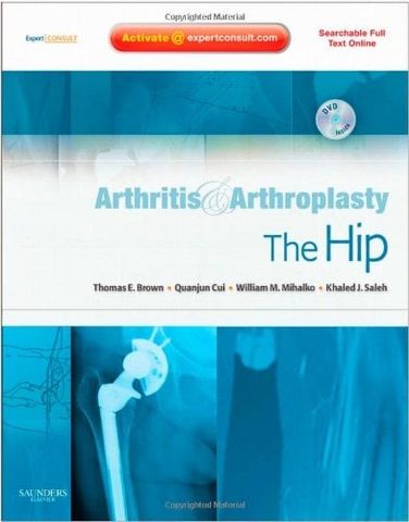 Arthritis and Arthroplasty: The Hip