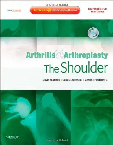 Arthritis and Arthroplasty: The Shoulder