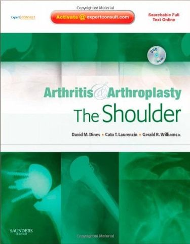 Arthritis and Arthroplasty: The Shoulder