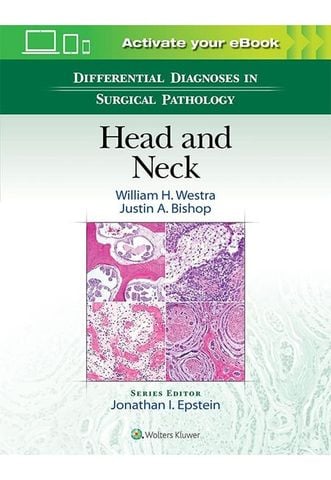 Differential Diagnoses in Surgical Pathology Head and Neck