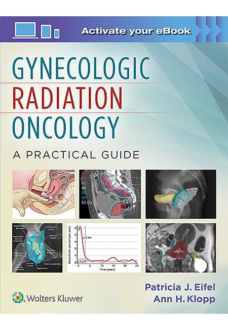 Gynecologic Radiation Oncology: A Practical Guide