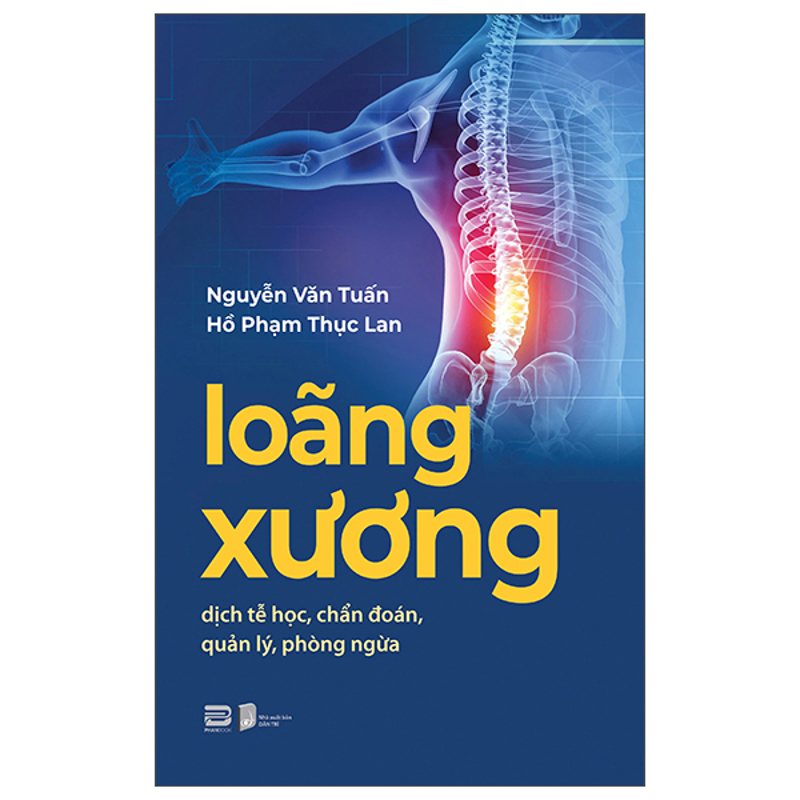 Loãng Xương - Dịch Tễ Học, Chẩn Đoán, Quản Lý, Phòng Ngừa