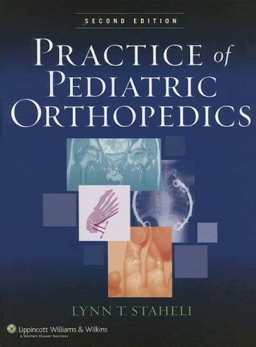Practice of Pediatric Orthopedics
