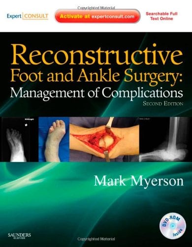 Reconstructive Foot and Ankle Surgery: Management of Complications, 2nd edition