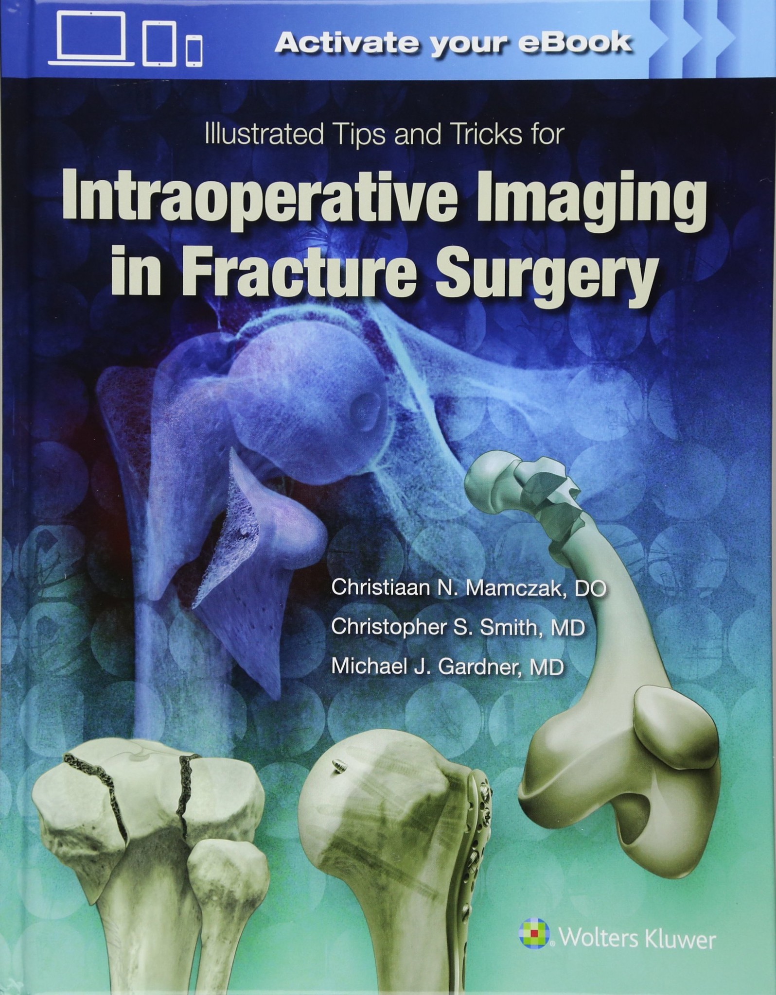 Illustrated Tips and Tricks for Intraoperative Imaging in Fracture Surgery