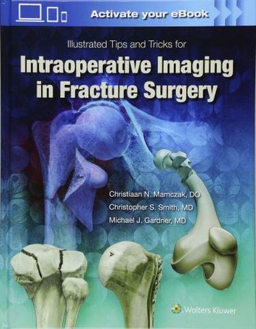 Illustrated Tips and Tricks for Intraoperative Imaging in Fracture Surgery