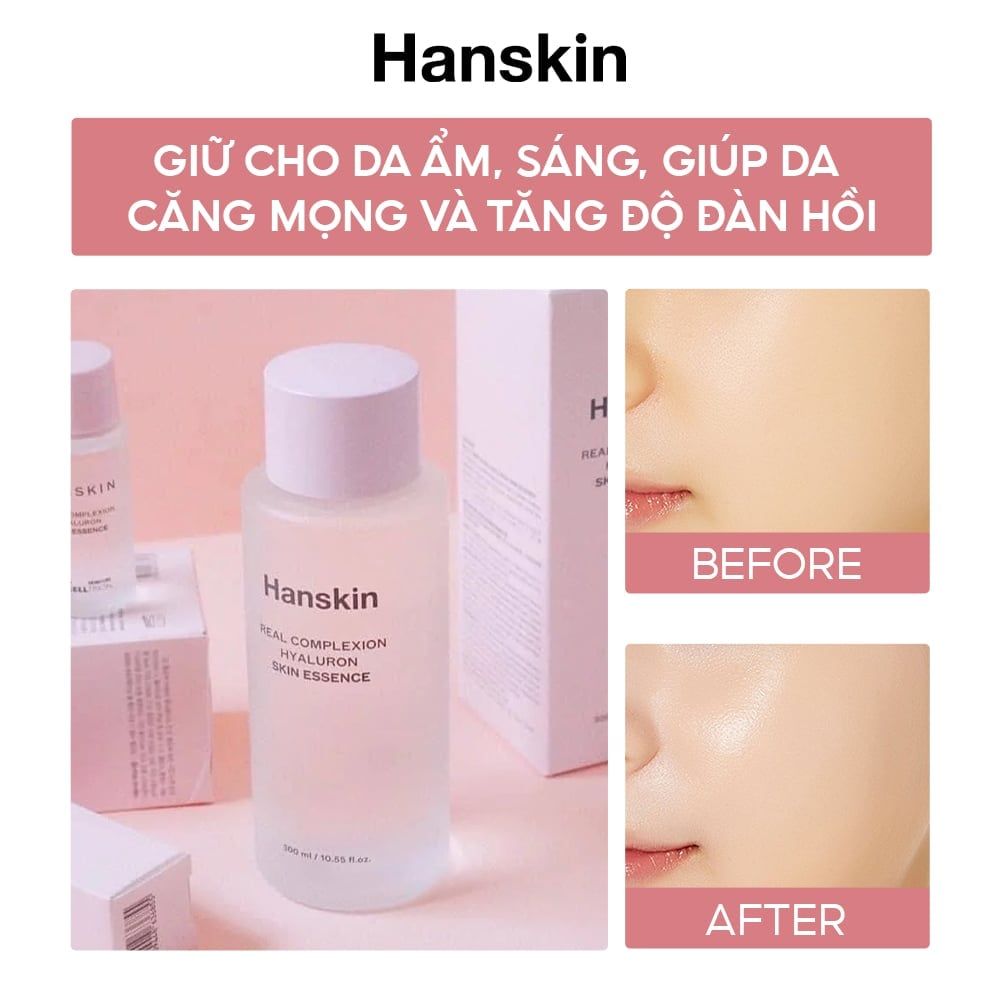Tinh Chất Dưỡng Ẩm Hanskin Real Complexion Hyaluron Skin Essence (Beautyworld)