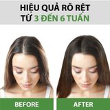  Combo Dầu Gội & Kem Ủ Bưởi MILAGANICS - Tinh Dầu Bưởi, Dưỡng Tóc, Kích Mọc, Ngăn Rụng 