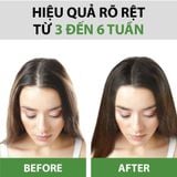  [COMBO TẶNG 1] Combo Dầu Gội & Dầu Xả Tinh Dầu Bưởi MILAGANICS 250ml 