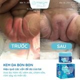  Combo Tắm Gội Thảo Mộc Giảm Rôm Sảy, Dịu Hăm, Viêm Da Cho Bé Bon Bon 