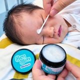  Kem Bôi Chàm Sữa, Mụn Cà Kê Cho Bé Bon Bon Premium: Chuyên Gia Tin Dùng 