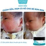 Kem Bôi Chàm Sữa, Mụn Cà Kê Cho Bé Bon Bon Premium: Chuyên Gia Tin Dùng 