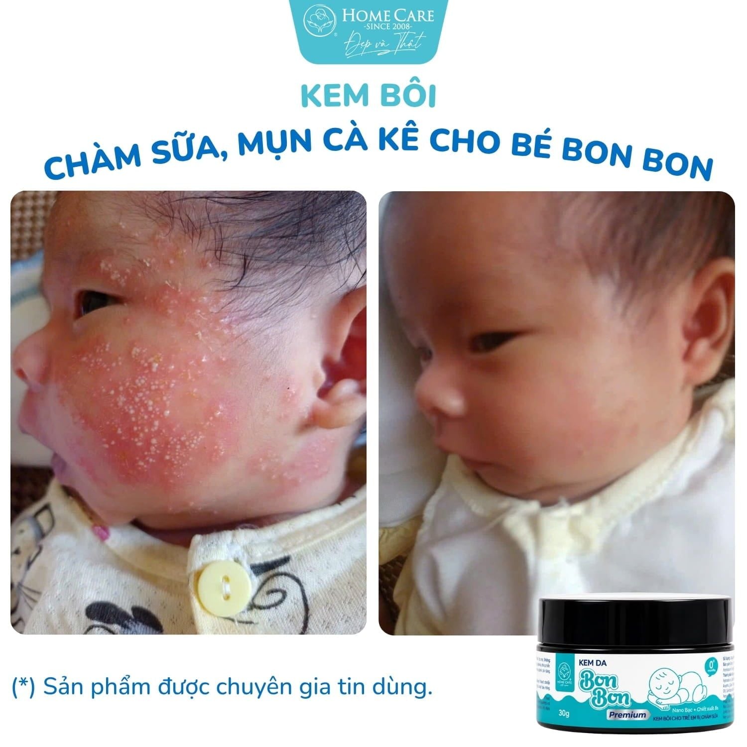 Feedback mẹ bỉm - Da bé mềm mịn