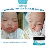  Kem Bôi Chàm Sữa, Mụn Cà Kê Cho Bé Bon Bon Premium: Chuyên Gia Tin Dùng 