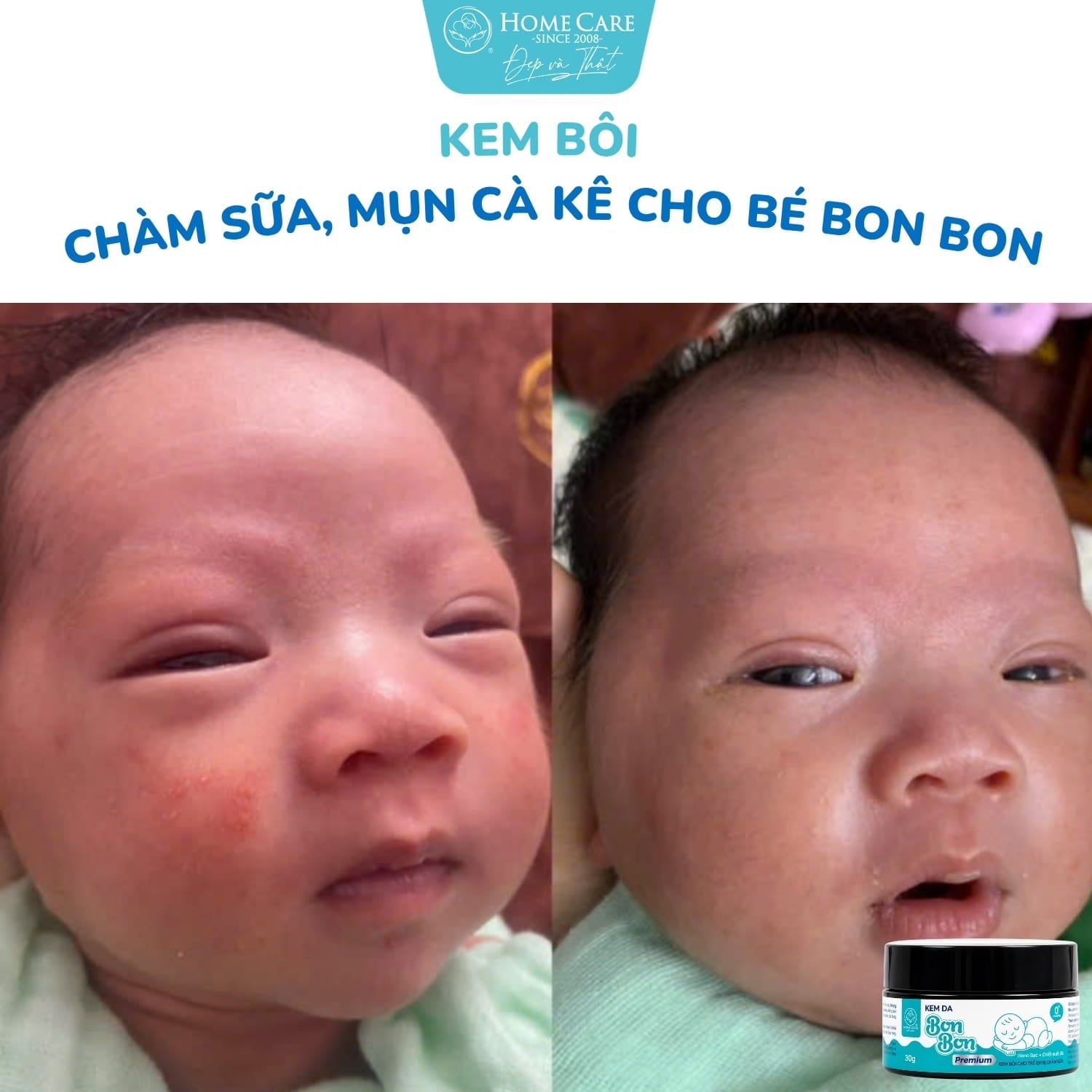 Bong tróc, nứt nẻ