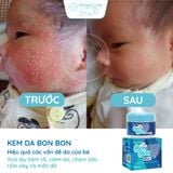  [Mua 1 Tặng 1] Kem Bôi Hăm Tã, Rôm Sảy, Viêm Da, Chàm Sữa Cho Bé Từ 0M+ | Kem Da Bon Bon 