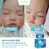  [Mua 1 Tặng 1] Kem Bôi Hăm Tã, Rôm Sảy, Viêm Da, Chàm Sữa Cho Bé Từ 0M+ | Kem Da Bon Bon 