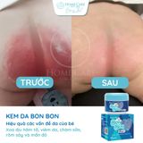  Combo Tắm Gội Thảo Mộc Giảm Rôm Sảy, Dịu Hăm, Viêm Da Cho Bé Bon Bon 