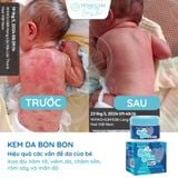  [Mua 1 Tặng 1] Kem Bôi Hăm Tã, Rôm Sảy, Viêm Da, Chàm Sữa Cho Bé Từ 0M+ | Kem Da Bon Bon 