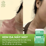  Kem Chăm Sóc Vết Mổ, Vết Khâu Tầng Sinh Môn | Kem Da Mây Mây 