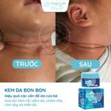  [Mua 1 Tặng 1] Kem Bôi Hăm Tã, Rôm Sảy, Viêm Da, Chàm Sữa Cho Bé Từ 0M+ | Kem Da Bon Bon 