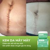  Kem Chăm Sóc Vết Mổ, Vết Khâu Tầng Sinh Môn | Kem Da Mây Mây 