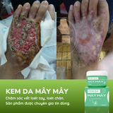  Kem Chăm Sóc Vết Mổ, Vết Khâu Tầng Sinh Môn | Kem Da Mây Mây 