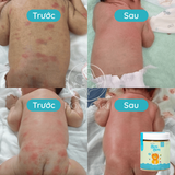  [Mua 1 Tặng 1] Muối Tắm Cho Bé Bon Bon - Giảm Rôm Sảy, Hăm Da & Ngủ Ngon 