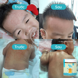  [Mua 1 Tặng 1] Muối Tắm Cho Bé Bon Bon - Giảm Rôm Sảy, Hăm Da & Ngủ Ngon 