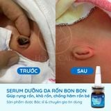  [Mua 1 Tặng 1] Serum Dưỡng Rốn Cho Bé Giúp Rụng Rốn, Khô Rốn, Chống Hăm Rốn 