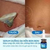  [Mua 1 Tặng 1] Serum Dưỡng Rốn Cho Bé Giúp Rụng Rốn, Khô Rốn, Chống Hăm Rốn 