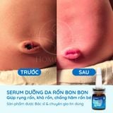  [Mua 1 Tặng 1] Serum Dưỡng Rốn Cho Bé Giúp Rụng Rốn, Khô Rốn, Chống Hăm Rốn 