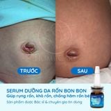  [Mua 1 Tặng 1] Serum Dưỡng Rốn Cho Bé Giúp Rụng Rốn, Khô Rốn, Chống Hăm Rốn 