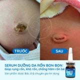  [Mua 1 Tặng 1] Serum Dưỡng Rốn Cho Bé Giúp Rụng Rốn, Khô Rốn, Chống Hăm Rốn 