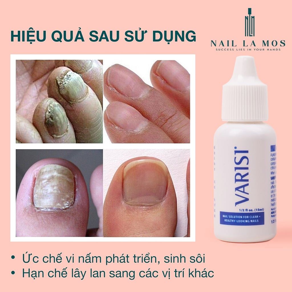 Varisi Dung Dịch Nấm Móng Varisi Nail Solution – NAIL LA MOS