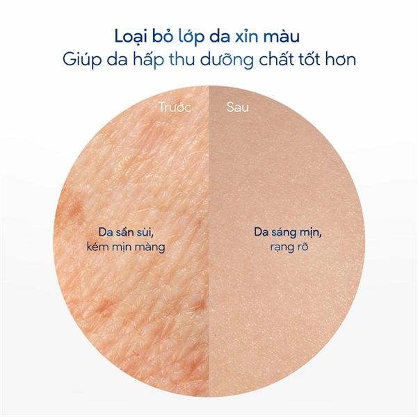Tẩy Tế Bào Chết Body DOVE Dưỡng Da Sáng Mịn Moisturizing Body Scrub 298g