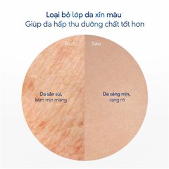Tẩy Tế Bào Chết Body DOVE Dưỡng Da Sáng Mịn Moisturizing Body Scrub 298g