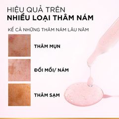 Serum L'oreal Tinh Chất Mờ Thâm Nám Glycolic-Bright Instant Glowing Serum 30ml