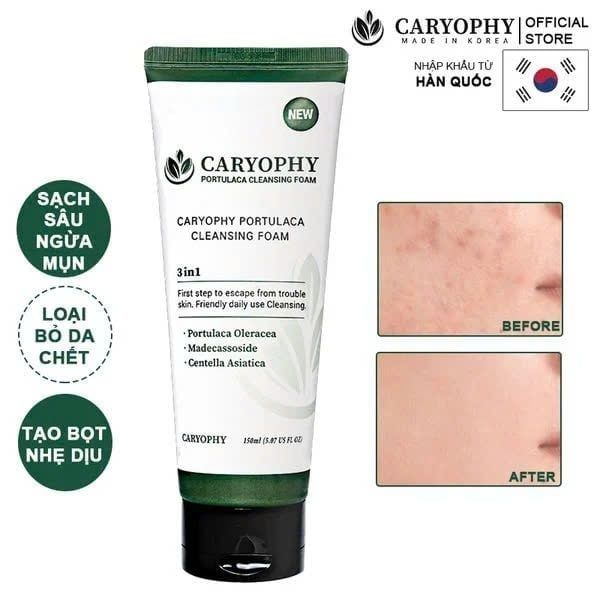 Sữa Rửa Mặt Ngăn Ngừa Mụn Giảm Thâm Caryophy Portulaca Cleansing Foam 150ml