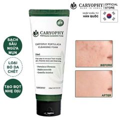 Sữa Rửa Mặt Ngăn Ngừa Mụn Giảm Thâm Caryophy Portulaca Cleansing Foam 150ml