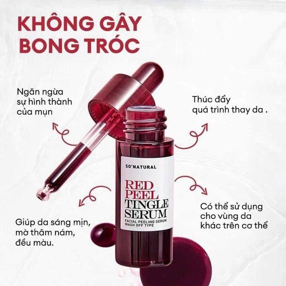 Tinh Chất Tẩy Da Chết So' Natural Red Peel Tingle Serum 35ml