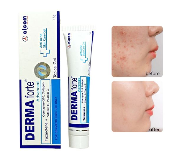 Kem Trị Mụn, Mờ Thâm Sẹo Derma Forte 15g