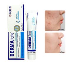 Kem Trị Mụn, Mờ Thâm Sẹo Derma Forte 15g