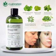 Nước Hoa Hồng Caryophy Ngừa Mụn Kiềm Dầu Giảm Thâm 300ml