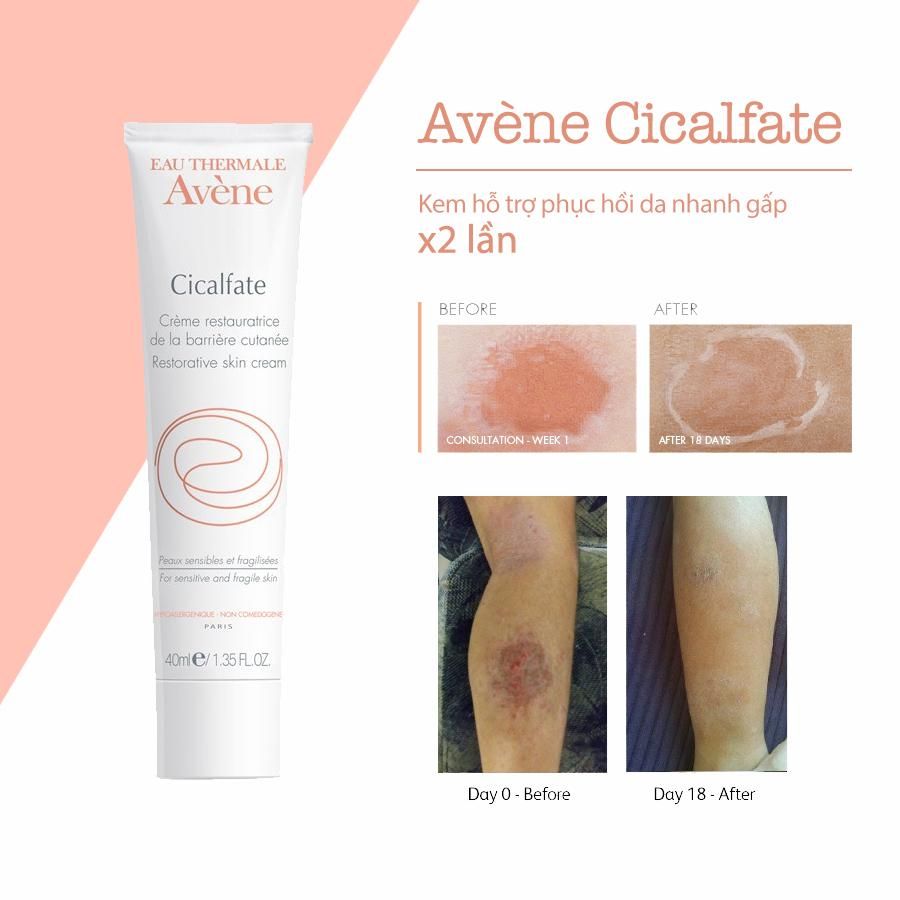 Kem Tái Tạo Và Phục Hồi Da Avene Cicalfate Repair Cream 100ML