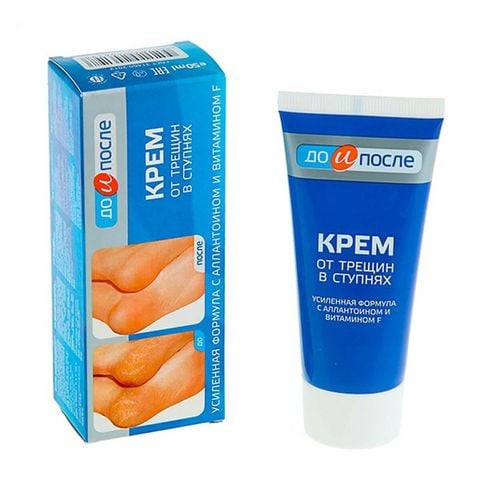 Kem trị nứt gót chân Kpem của Nga 50ml