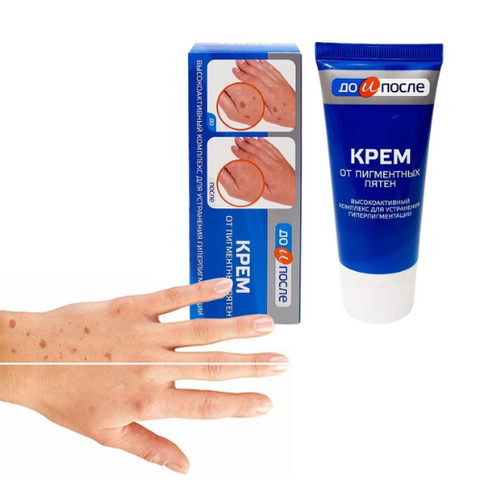 Kem Dưỡng Làm Mờ Phục Hồi Đốm Nâu Đồi Mồi Kpem Cream 50g