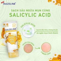 Sữa Rửa Mặt Hazeline Giảm Mụn Nghệ Hoa Cúc 100g [tặng 1 SRM Tràm Trà Cica 40gr]